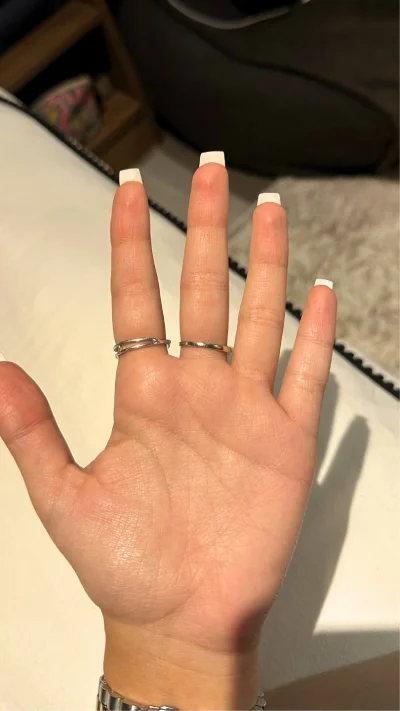 Dry palms after Hidroxa iontophoresis treatment for palmar hyperhidrosis