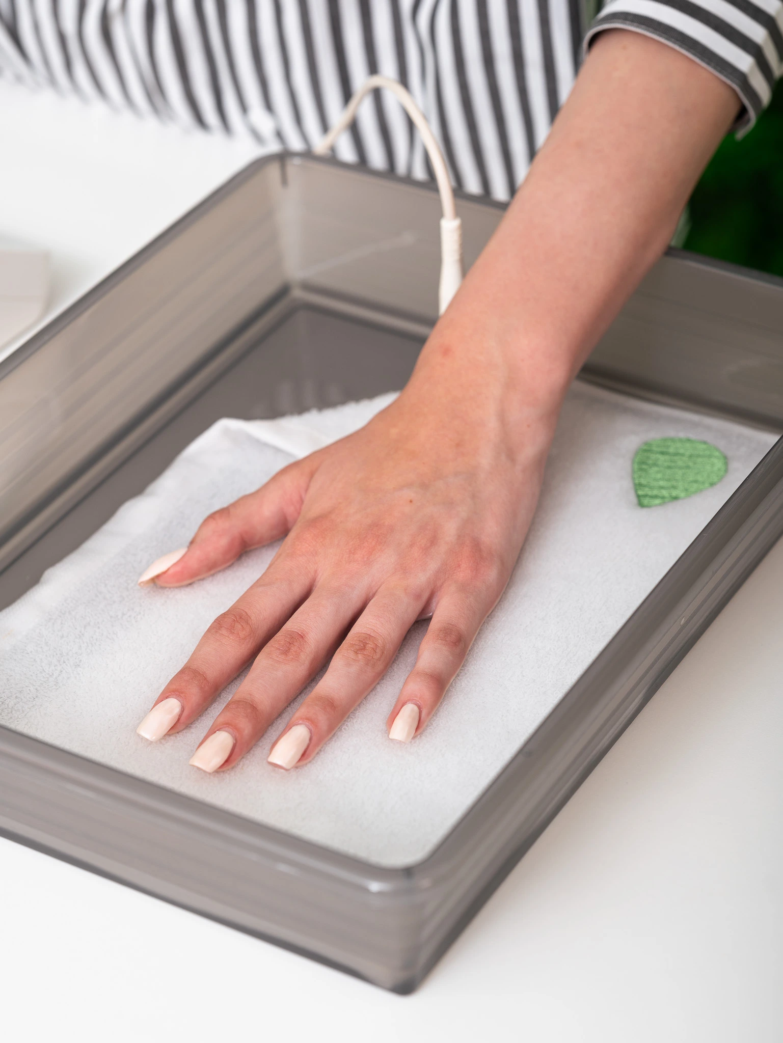 Treating excessive sweating hands with Hidroxa iontophoresis machine