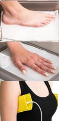 Hidroxa iontophoresis machine setup guide starting the treatment for sweaty hands feet and underarms